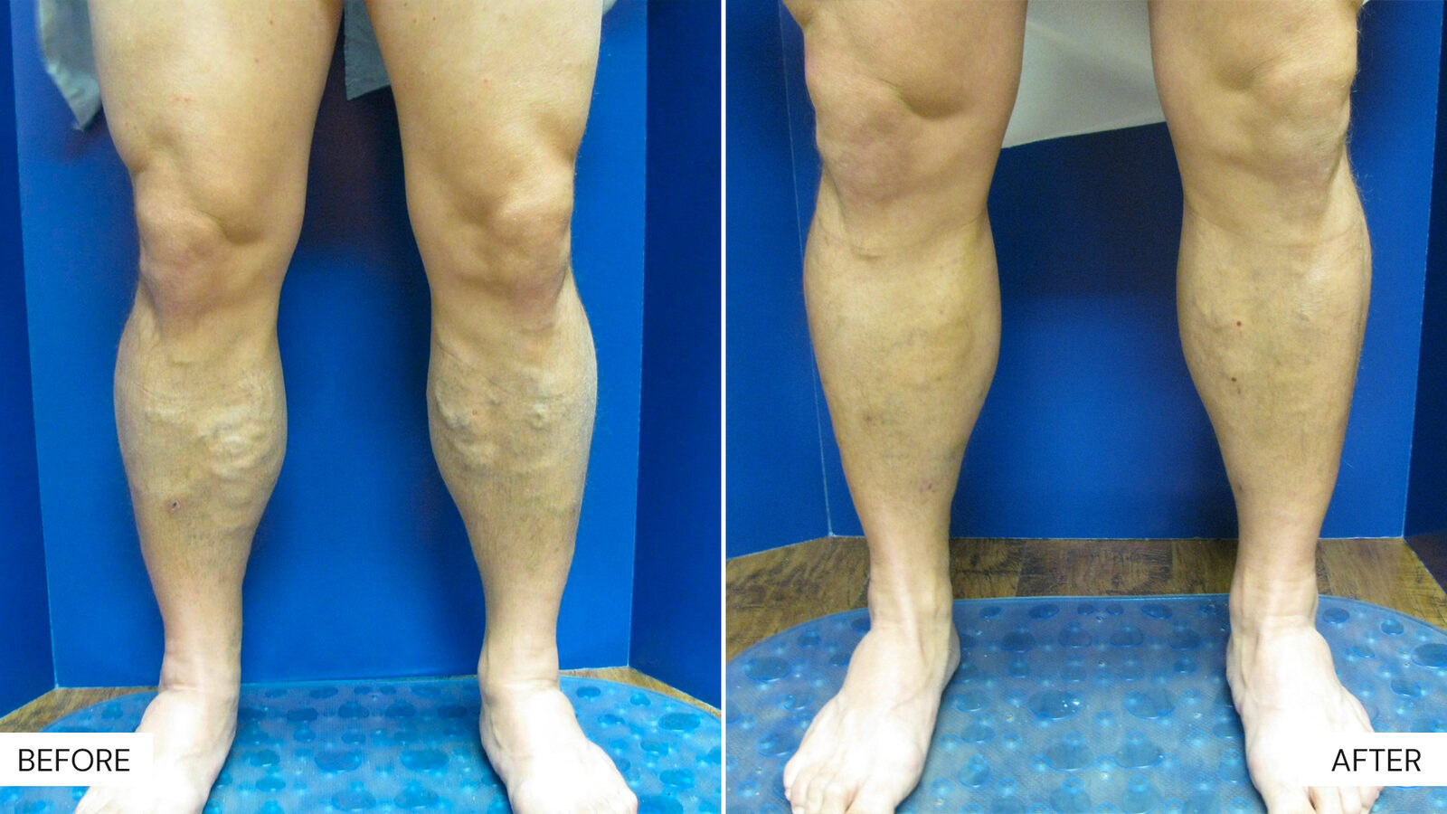 Before and After