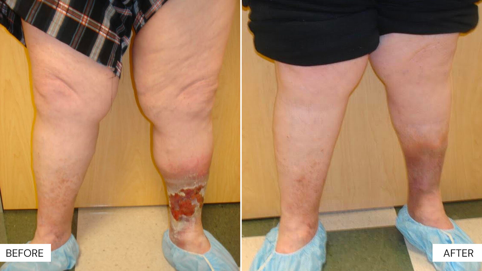 Before and After